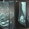 W szpitalu klinicznym MSWiA w Olsztynie otwarto nową pracownię mammografii.